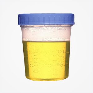 Desi Cow Urine